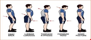 حرکات اصلاحی